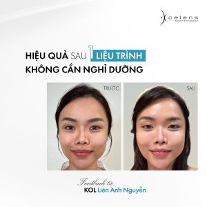 da cổ sần sùi