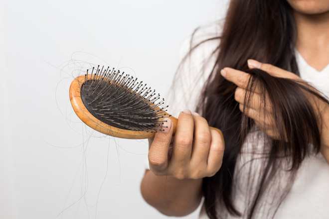 Số lượng tóc rụng vượt 150 mỗi ngày là một tình trạng đáng báo động 