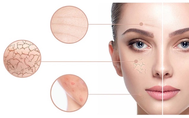 Khắc phục được nhiều vấn đề da giúp da tăng cường tái tạo sáng khỏe hơn