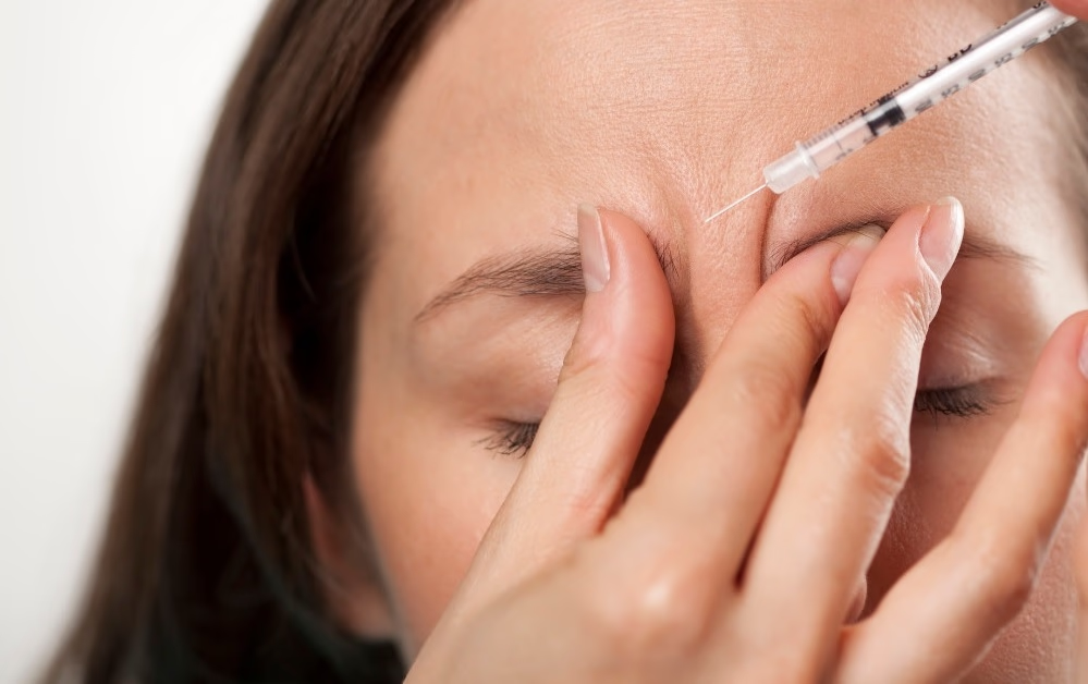 ấn đường có nếp nhăn 