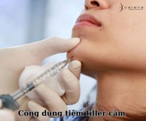 giá tiêm filler cằm