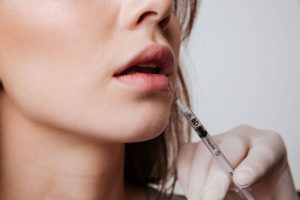 filler vón cục
