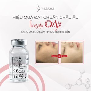 tăng sắc tố sau viêm là gì