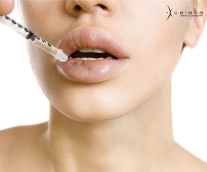 cách làm tan filler vón cục