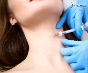 chăm sóc da sau mesotherapy