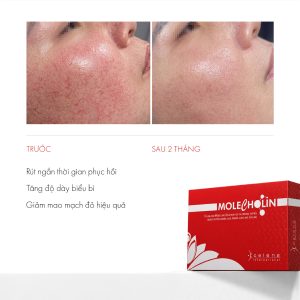 Meso phục hồi da