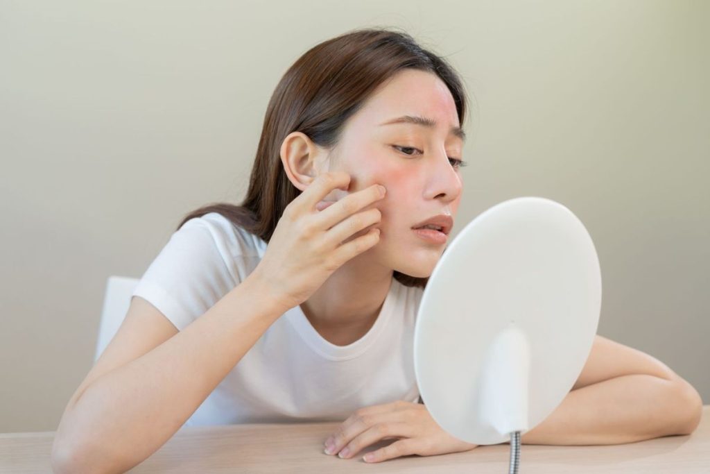 da mỏng yếu
