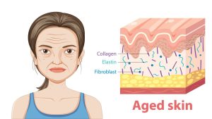 phục hồi da lão hóa