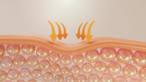 hàng rào bảo vệ da