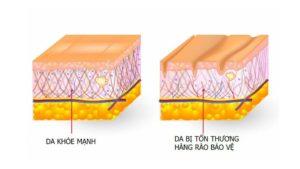 hàng rào bảo vệ da