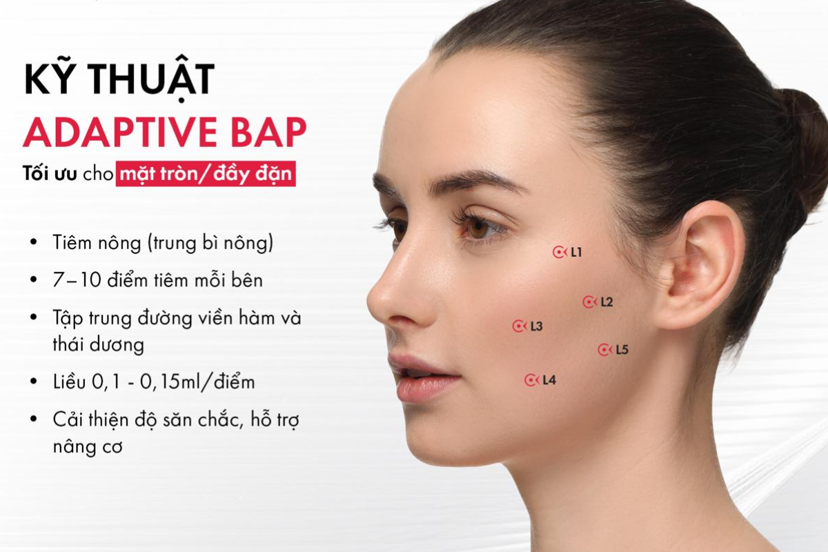 Adaptive BAP
