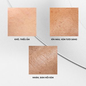 Phác Đồ Firming 4D: