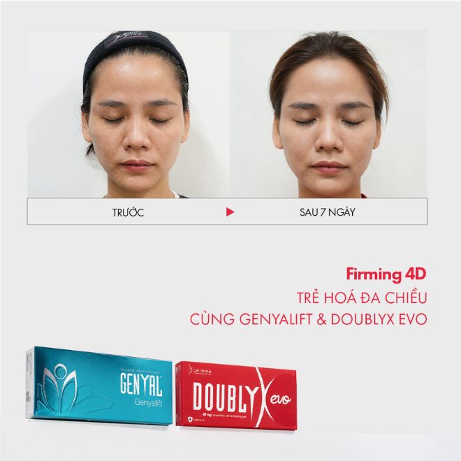Trẻ Hóa Đa Tầng Cùng Firming 4D