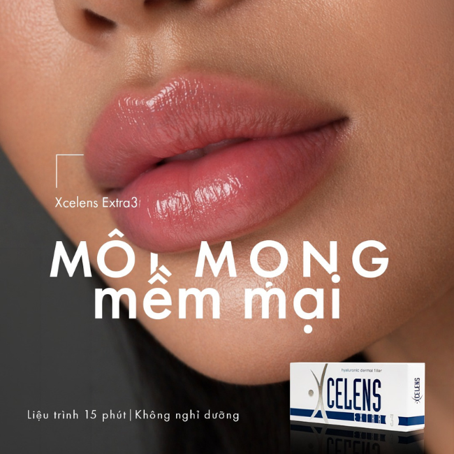 Tiêm filler môi là gì? Cách chọn dáng môi và lưu ý an toàn