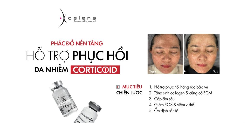 Da nhiễm corticoid
