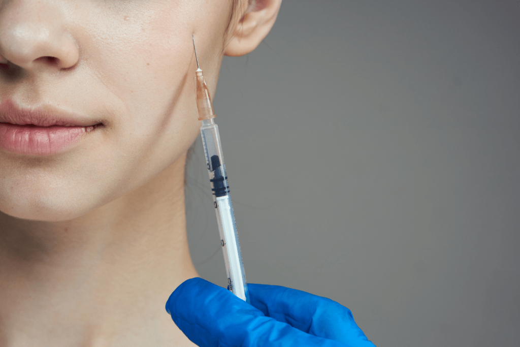 filler vón cục