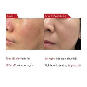 Lâm sàng Molecholin