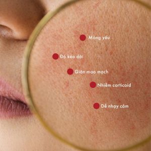 Da mỏng yếu cần được chăm sóc phục hồi