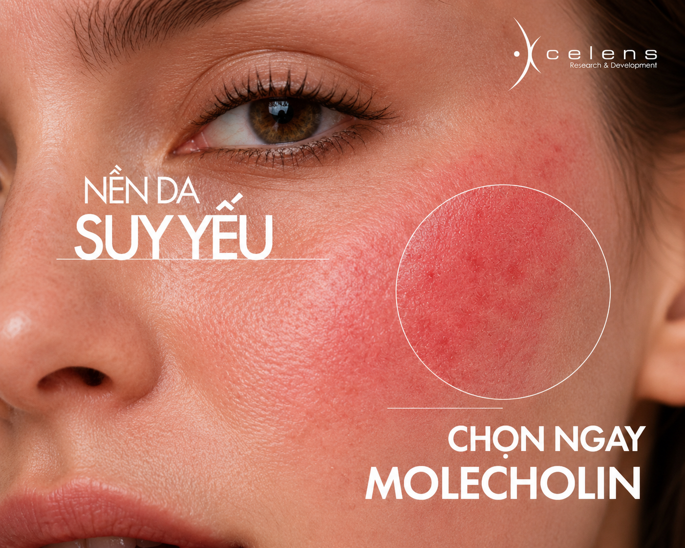 Phục hồi da mỏng yếu sau treatment: Hiểu đúng để lựa chọn giải pháp phù hợp