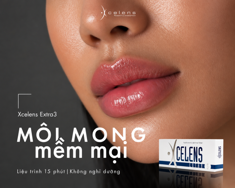 tiêm filler môi tự nhiên